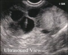 Image of an ultrasound