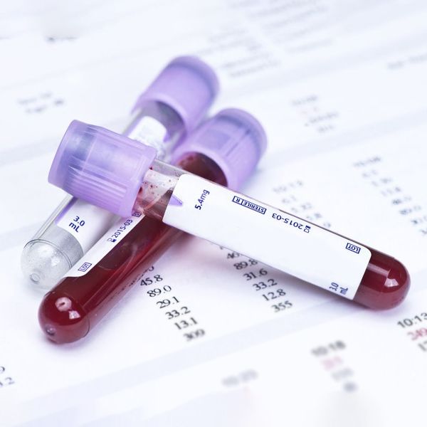blood tests
